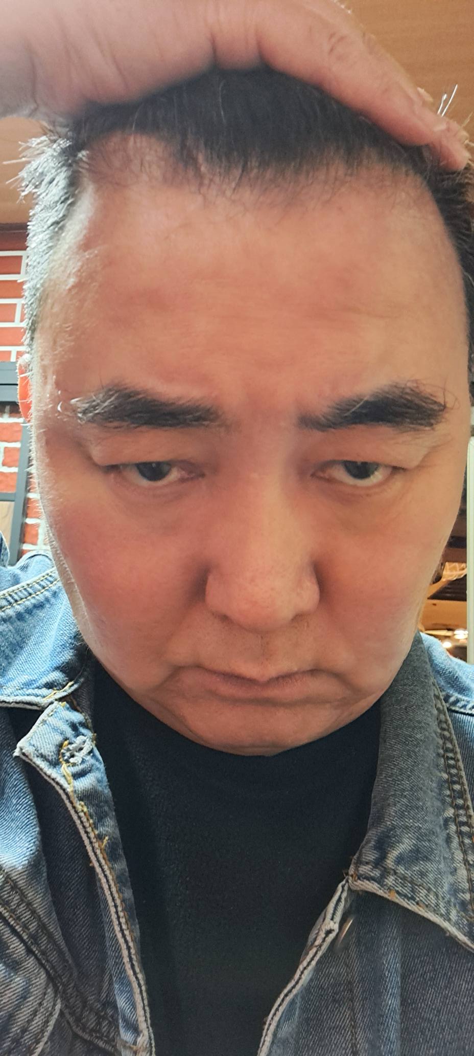 徐亨勇敢面對腦瘤挑戰！公開近況「腦開3洞裝導管」堅強還債，笑對人生低谷