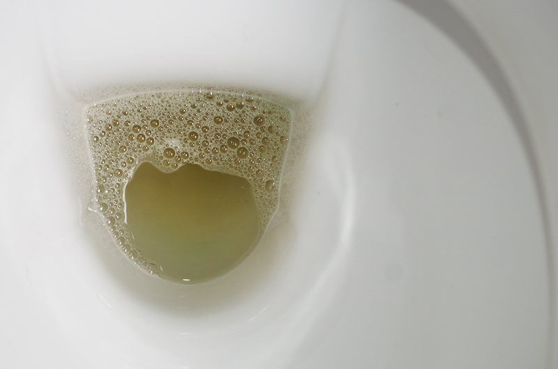 驚人病例！60歲男「泡泡尿」藏致命危機 醫驚見「腸道直通膀胱」急示警