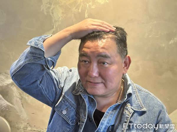 徐亨勇敢面對腦瘤挑戰！公開近況「腦開3洞裝導管」堅強還債，笑對人生低谷