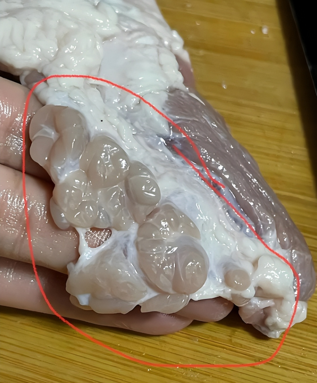 一家愛吃餛飩！5旬男子癌逝「妻兒也接連罹癌」　醫生「揪出真兇」她崩潰痛哭：貪便宜害全家