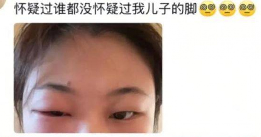驚！34歲女星聞嬰兒腳致眼睛嚴重感染 醫生警告：寶寶這3部位細菌超多