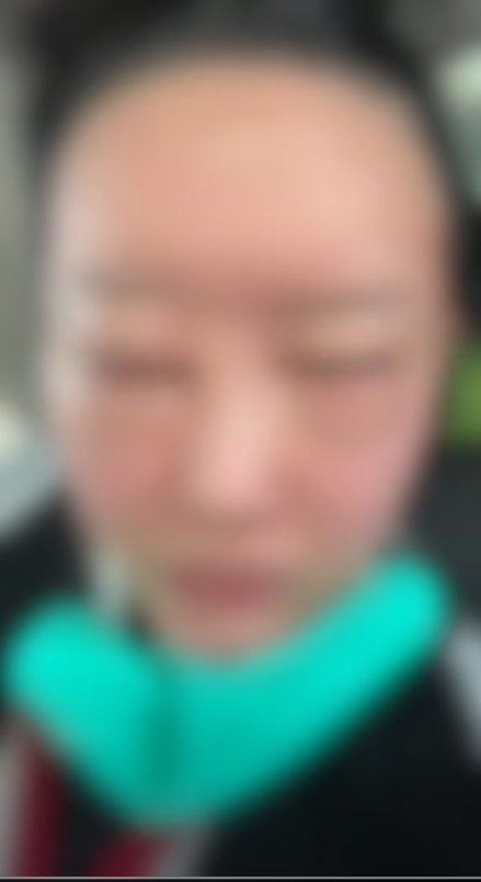 驚！34歲女星聞嬰兒腳致眼睛嚴重感染 醫生警告：寶寶這3部位細菌超多