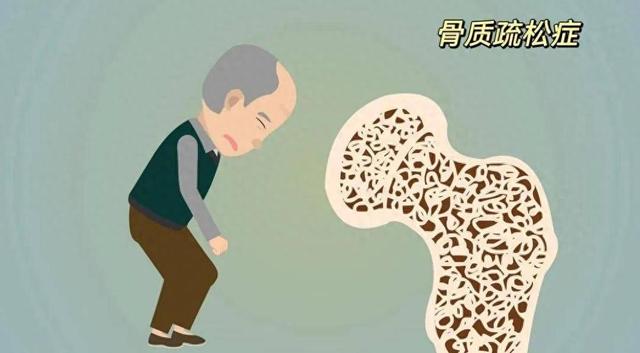 研究揭示：每日散步「輕鬆對抗骨質疏鬆」 醫師推薦「6大好處」讓你骨骼更健康