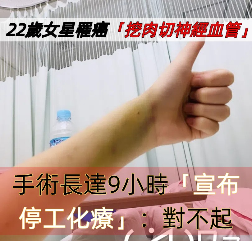 22歲女星菅原雛勇敢抗癌！左腳劇痛揭罕見癌症「滑膜肉瘤」 歷經9小時手術切腫瘤、神經血管 未來恐無法再跳舞