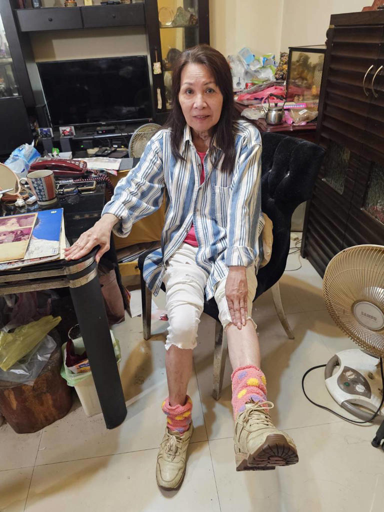 一度吞藥輕生！台語歌后「動刀2次竟半癱」痛哭：等於是廢人　72歲不放棄「想再站起來」