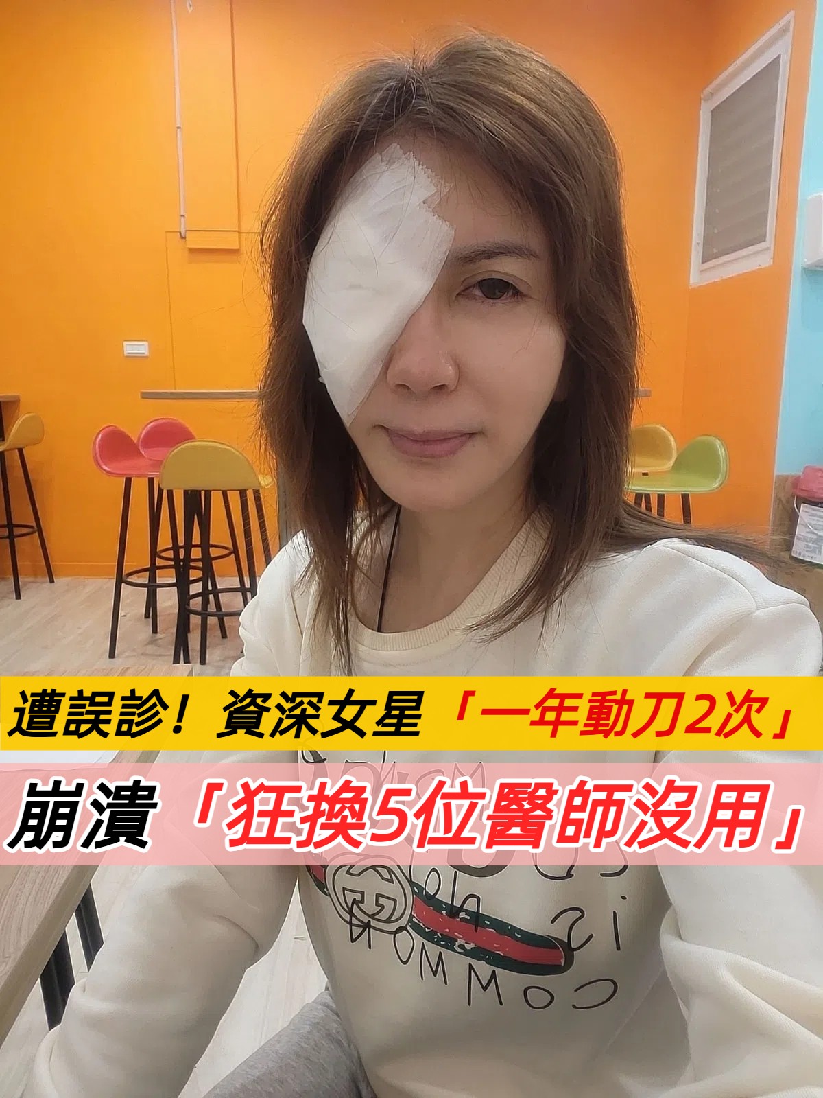 資深女星王瀞文眼部手術驚魂記：從誤診到重見光明的漫長旅程