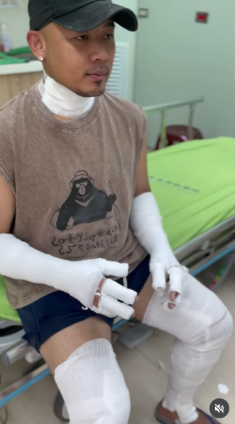 老公才氣爆送醫！47歲大咖歌后「突PO血流不止照」　驚見「整隻纏滿繃帶」粉絲全嚇壞
