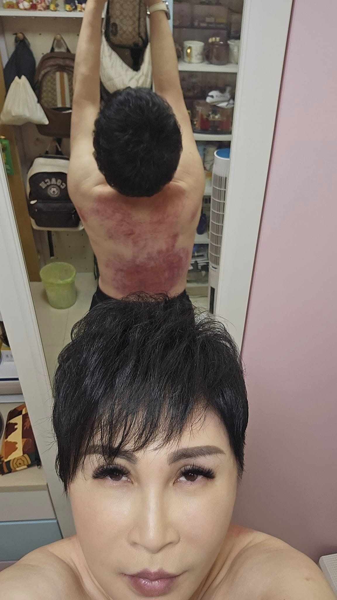 凌晨在家自摔！57歲名嘴「臉部著地昏迷」現況曝光　昔認「已簽器捐」後事交代好：要海葬