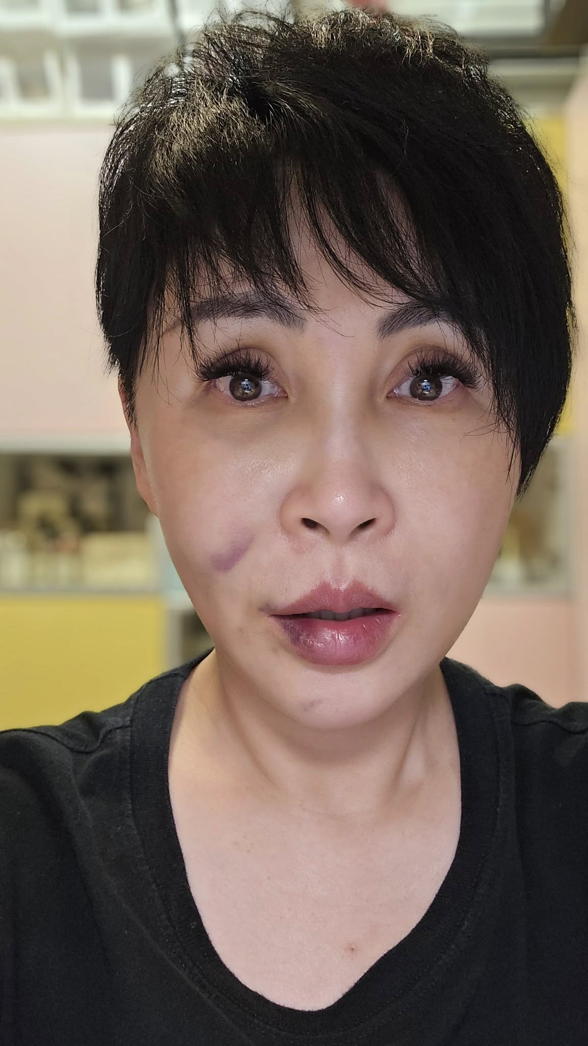 凌晨在家自摔！57歲名嘴「臉部著地昏迷」現況曝光　昔認「已簽器捐」後事交代好：要海葬