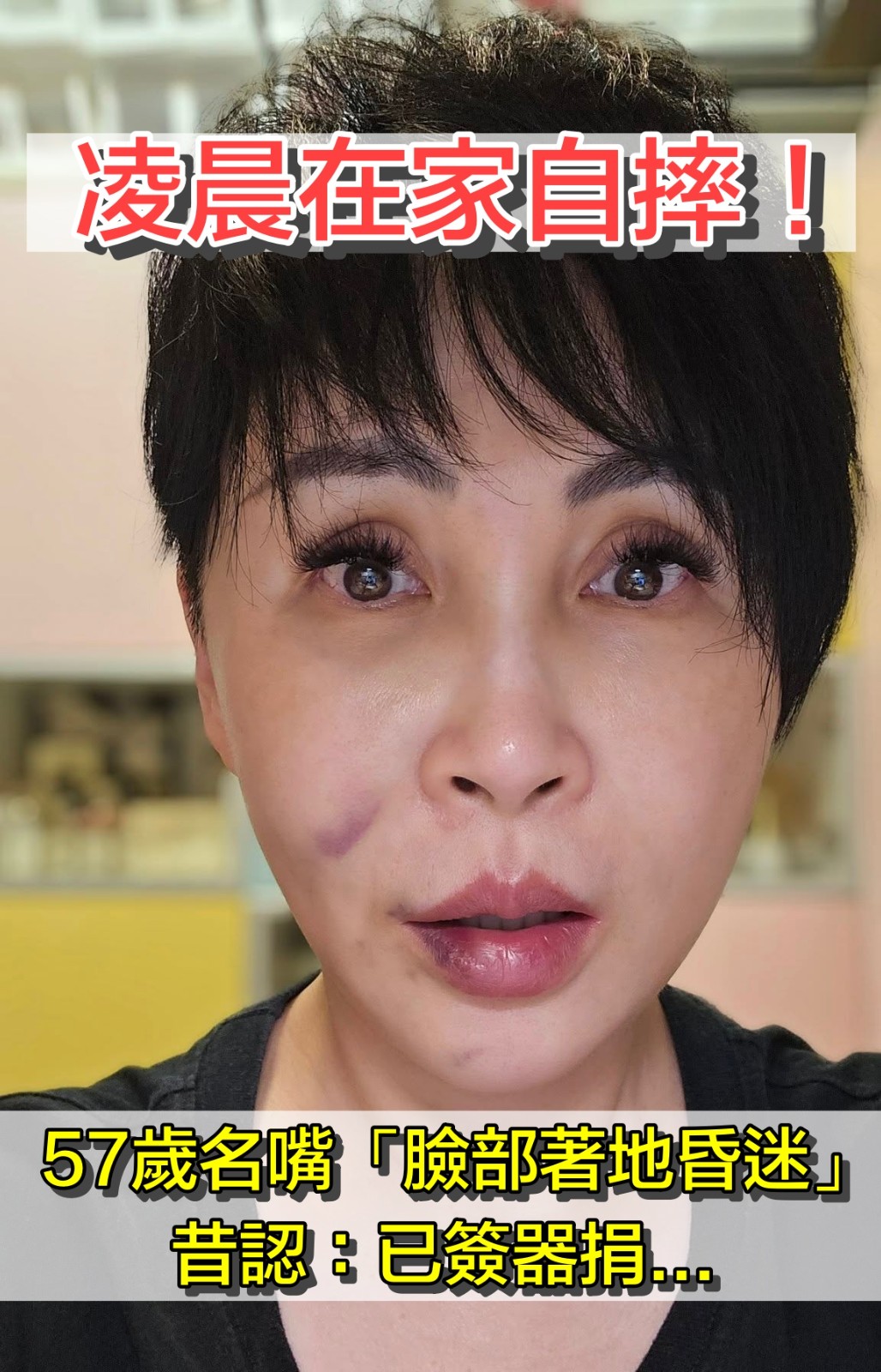 凌晨在家自摔！57歲名嘴「臉部著地昏迷」現況曝光　昔認「已簽器捐」後事交代好：要海葬