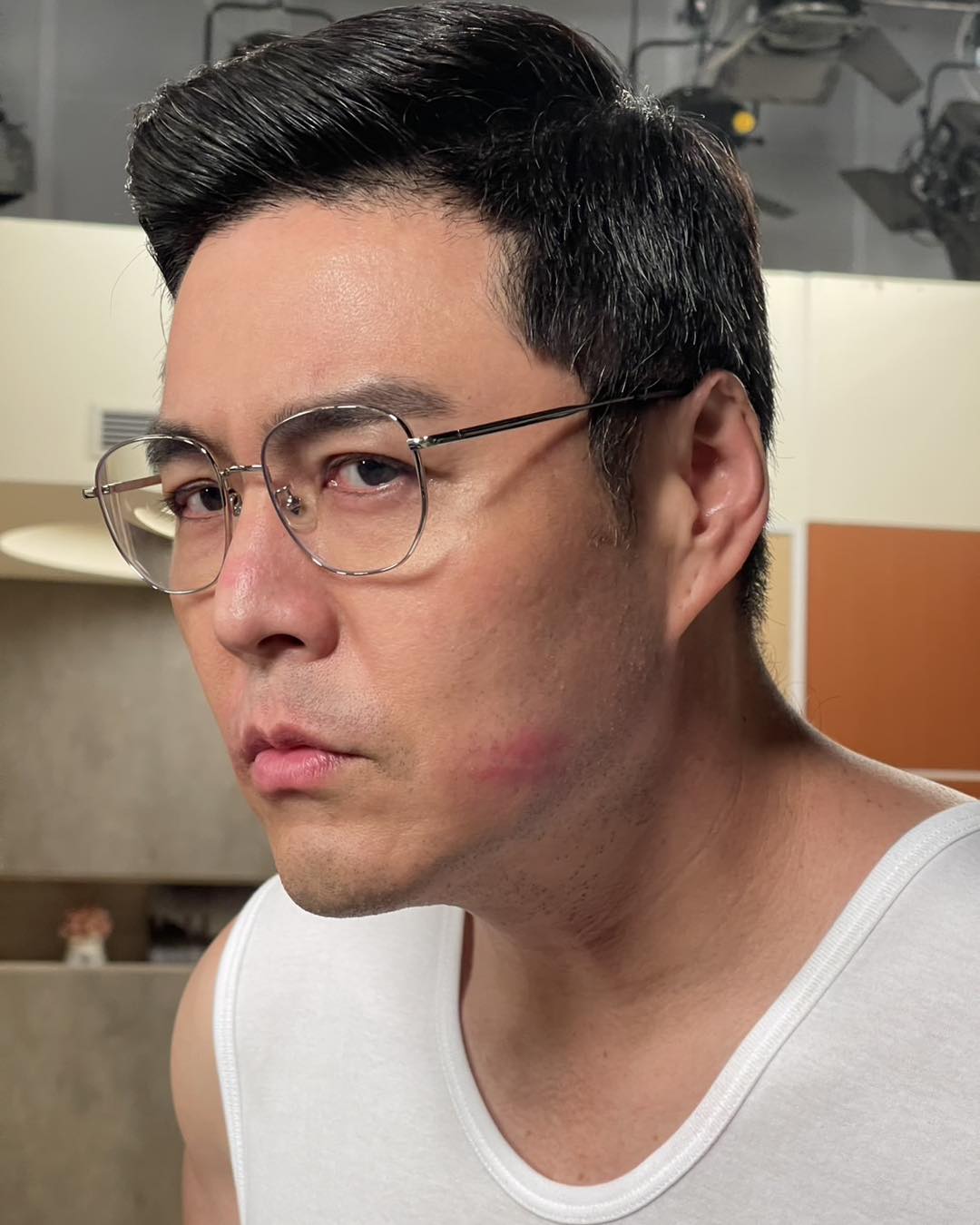 慘遭飛車拖行！八點檔男星「臉全磨爛」驚悚畫面曝　目睹女星「崩潰嚇哭」頻發抖