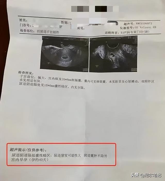 在家滑影片竟看到「老婆嫁別人」！才發現「她還有4個老公」猛賺800萬禮金