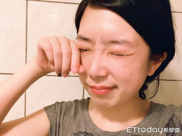 愛上溫泉SPA！44歲男子「驚傳視力降至0.6」緊急就醫　一查「變臉示警」：三場所要注意
