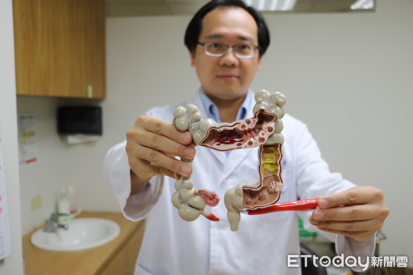 患者突問「痔瘡會遺傳嗎」！醫生揭秘「其實人人都有」：3關鍵很多人中