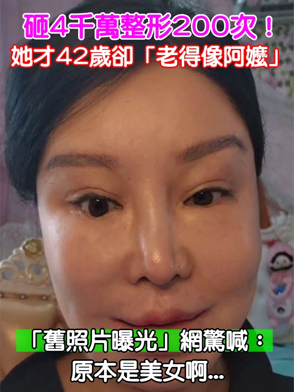 砸4千萬整形200次！她才42歲「卻老得像阿嬤」 「舊照片曝光」網驚喊： 是美女啊