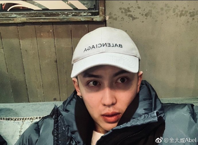 原本是大帥哥！人氣網帥「整形失敗毀容」彷彿老20歲　鏡頭前崩潰痛哭：「能別整就別整了...」