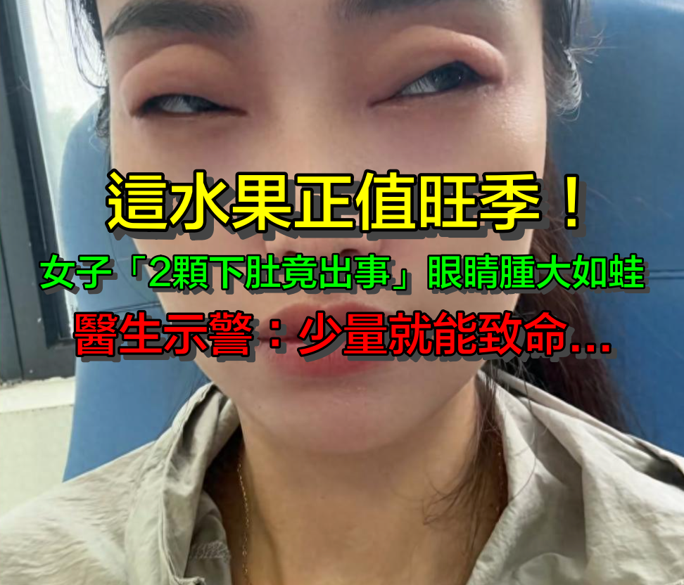 這水果正值旺季！女子「2顆下肚」竟出事：眼睛腫大如蛙　醫生示警「少量就能致命」別大意