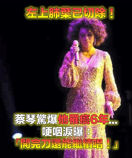 現身力挺蔡琴！70歲資深大咖歌手「舞台上驚喜重逢」　爆罹癌「左上肺葉已切除」蔡琴心疼淚崩