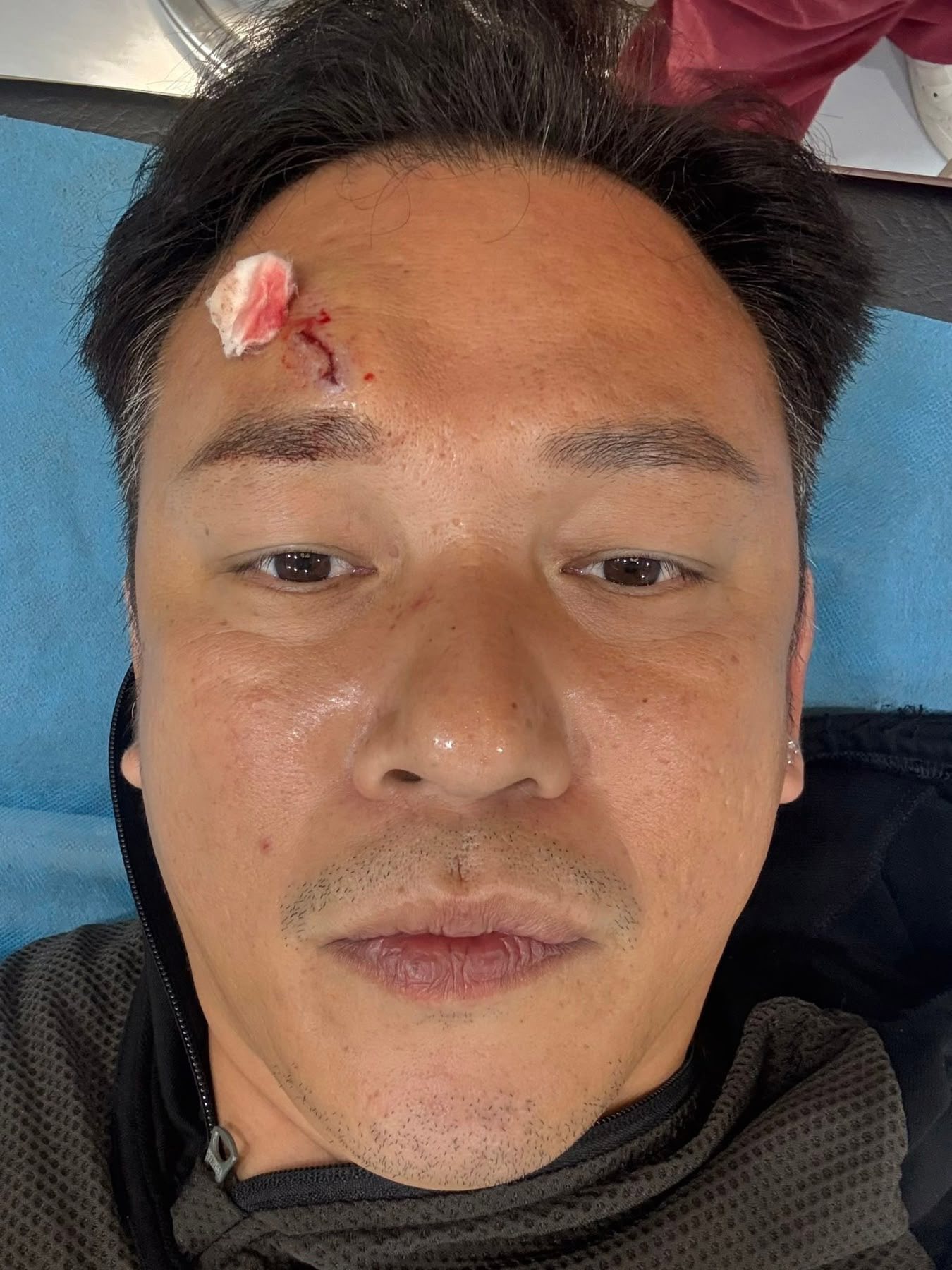 驚傳滿身是血送醫！45歲男星「拍戲出意外」畫面曝光　急喊「沒有怪任何人」公開病況