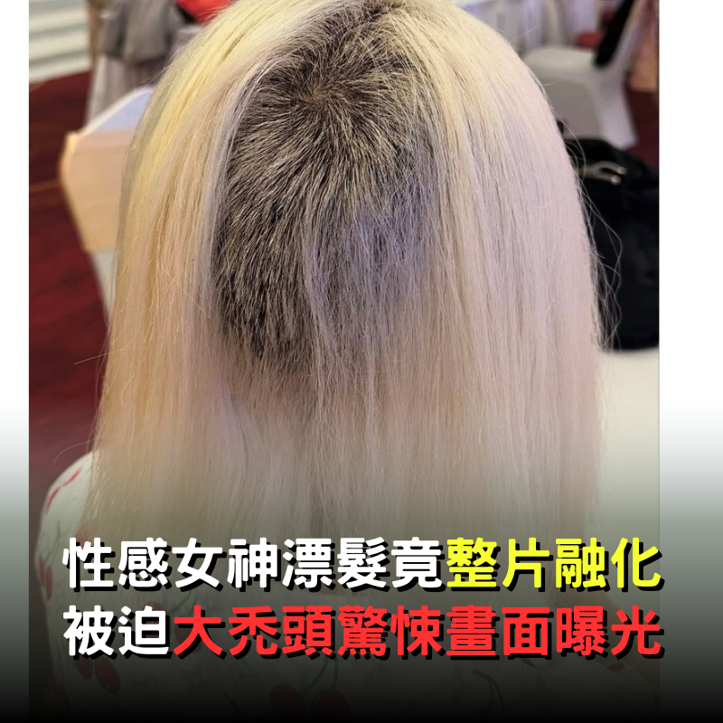花大錢漂髮！37歲性感女神後腦勺「頭髮整片融化」　大禿頭「驚悚畫面曝光」