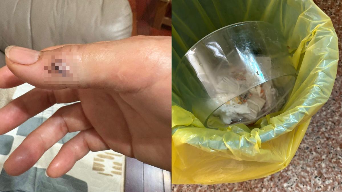 全聯道歉了！他換購1產品突自爆「割斷手臂肌腱」 釣出一堆受害者：「不止一次出問題」　