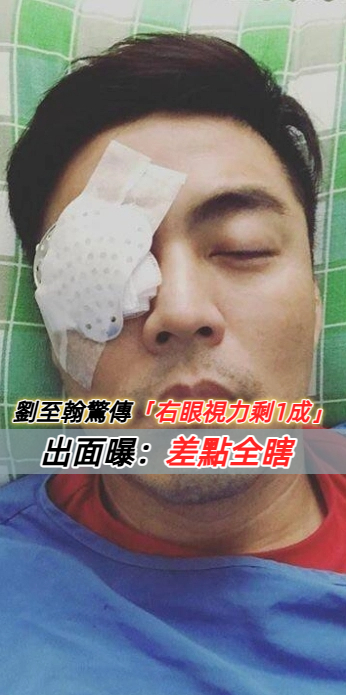 出狀況！劉至翰驚傳「右眼視力剩1成」　他出面「還原事發經過」：差點全瞎