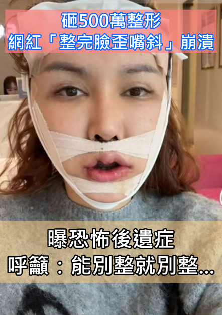 砸500萬整形！知名網紅「整失敗臉歪嘴斜」崩潰　曝恐怖後遺症呼籲「能別整就別整」