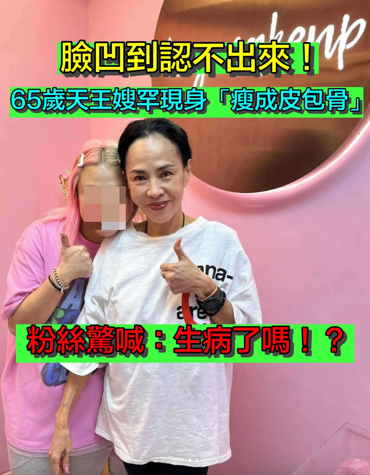 無預警暴瘦現身！65歲天王嫂「雙頰凹陷合照」下巴尖瘦　手臂「狀態驚悚」嚇壞：只剩皮包骨