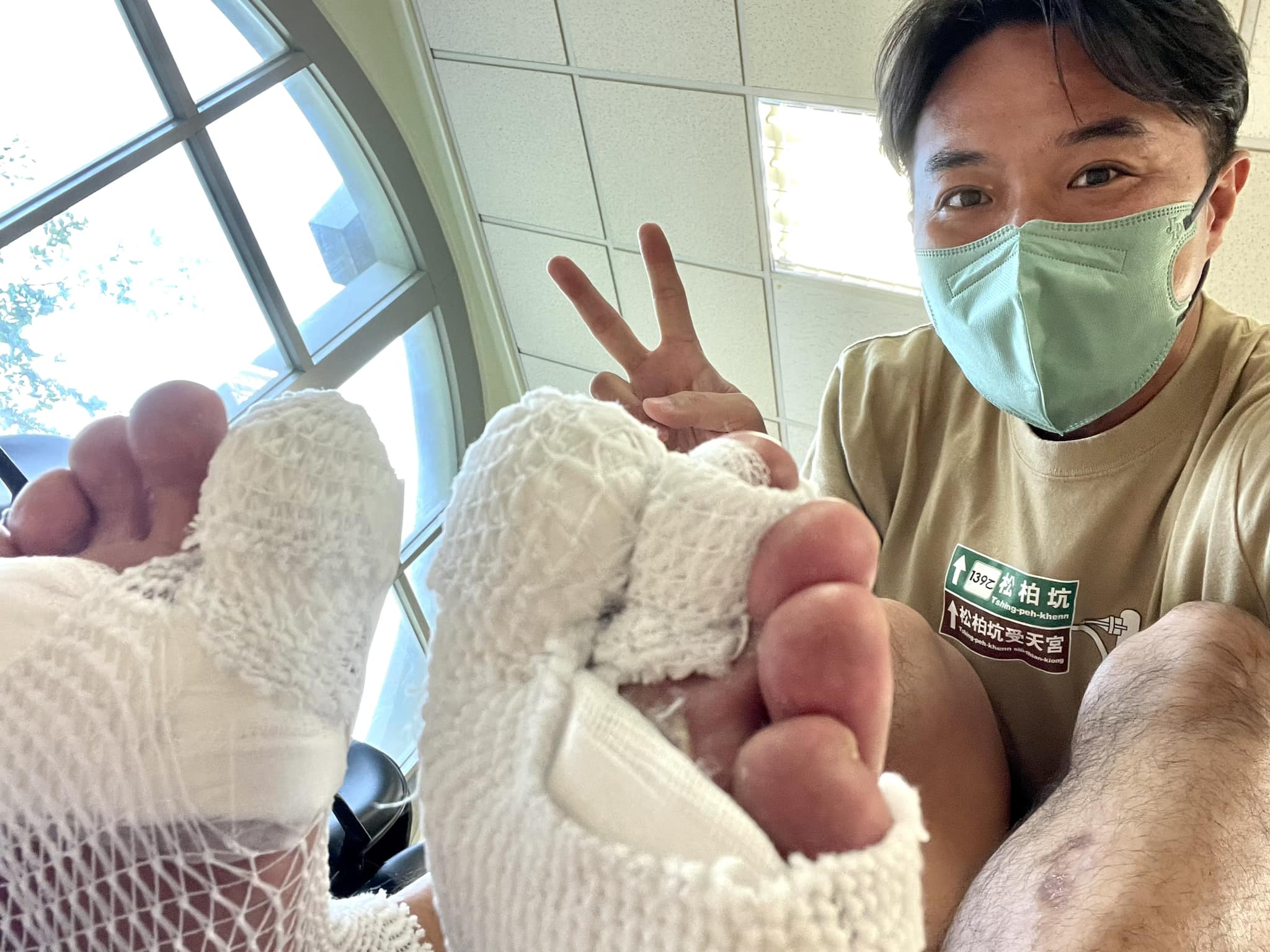錄外景出事！41歲金鐘主持人「皮被燙到掀起」恐怖畫面曝光　一度「大哭大笑」嚇壞：情緒難自控