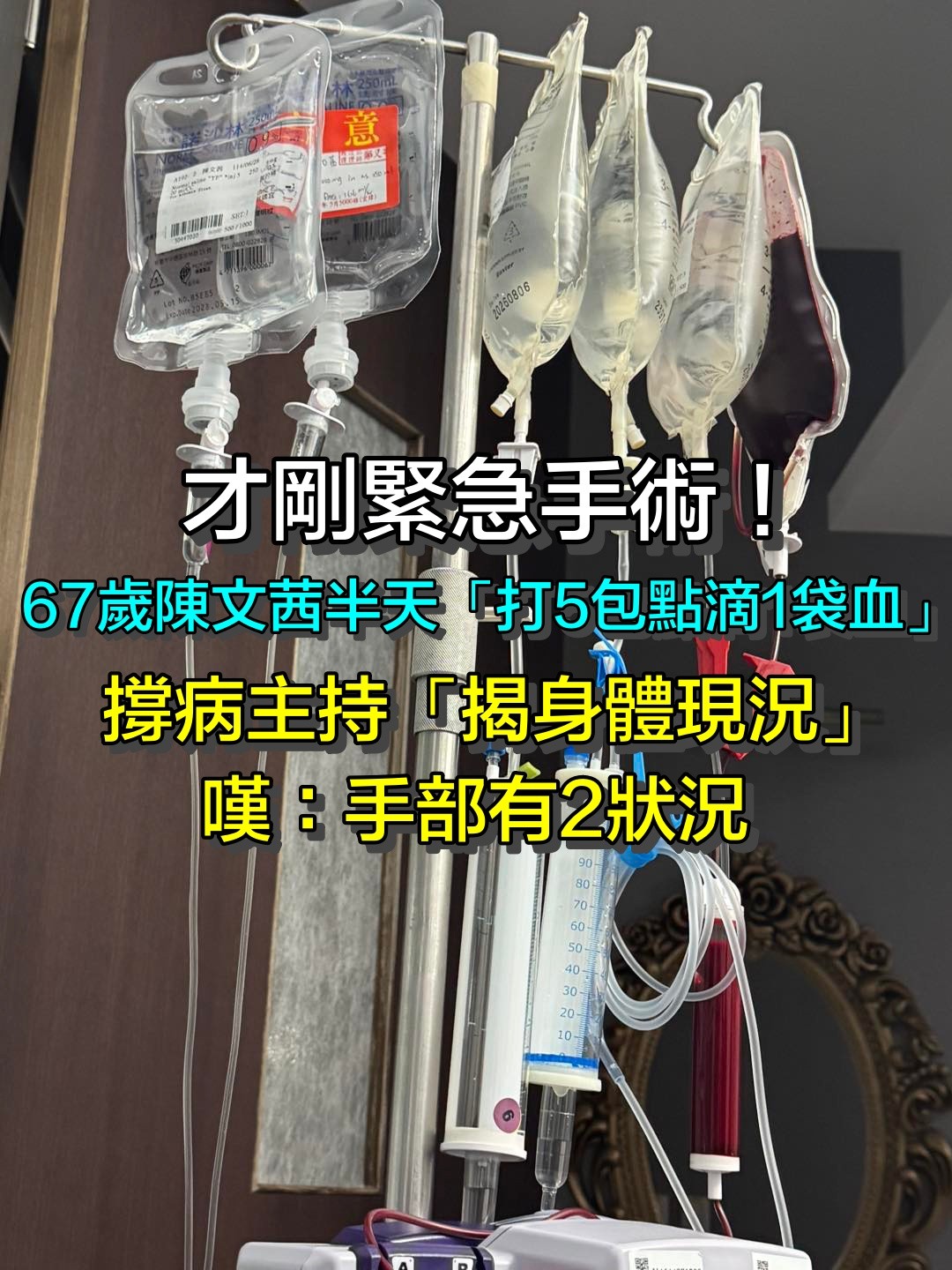 自嘲已成廢墟！67歲陳文茜「才剛緊急手術」曝：再打5包點滴1袋血　撐病主持「揭身體現況」
