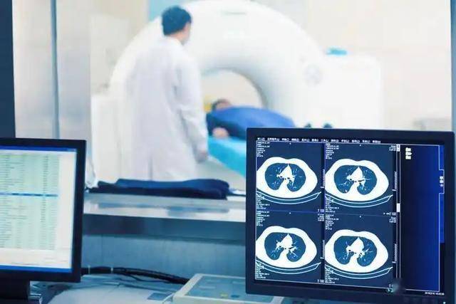 別盲目做！醫生坦言「照一次CT」恐有4大風險：三類人注意