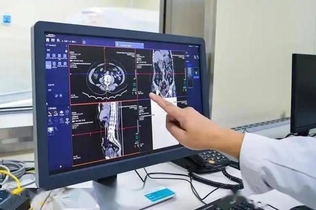 別盲目做！醫生坦言「照一次CT」恐有4大風險：三類人注意