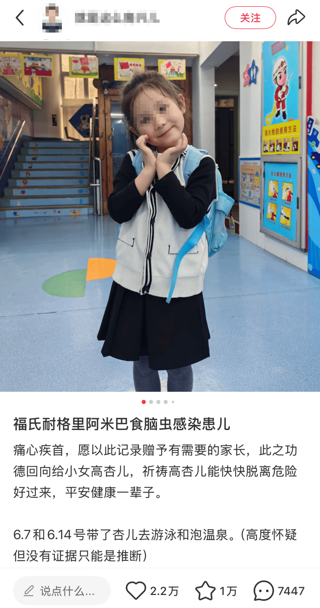 5歲女童泡溫後後「竟昏迷不醒」！送醫後確診感染了「食腦蟲」