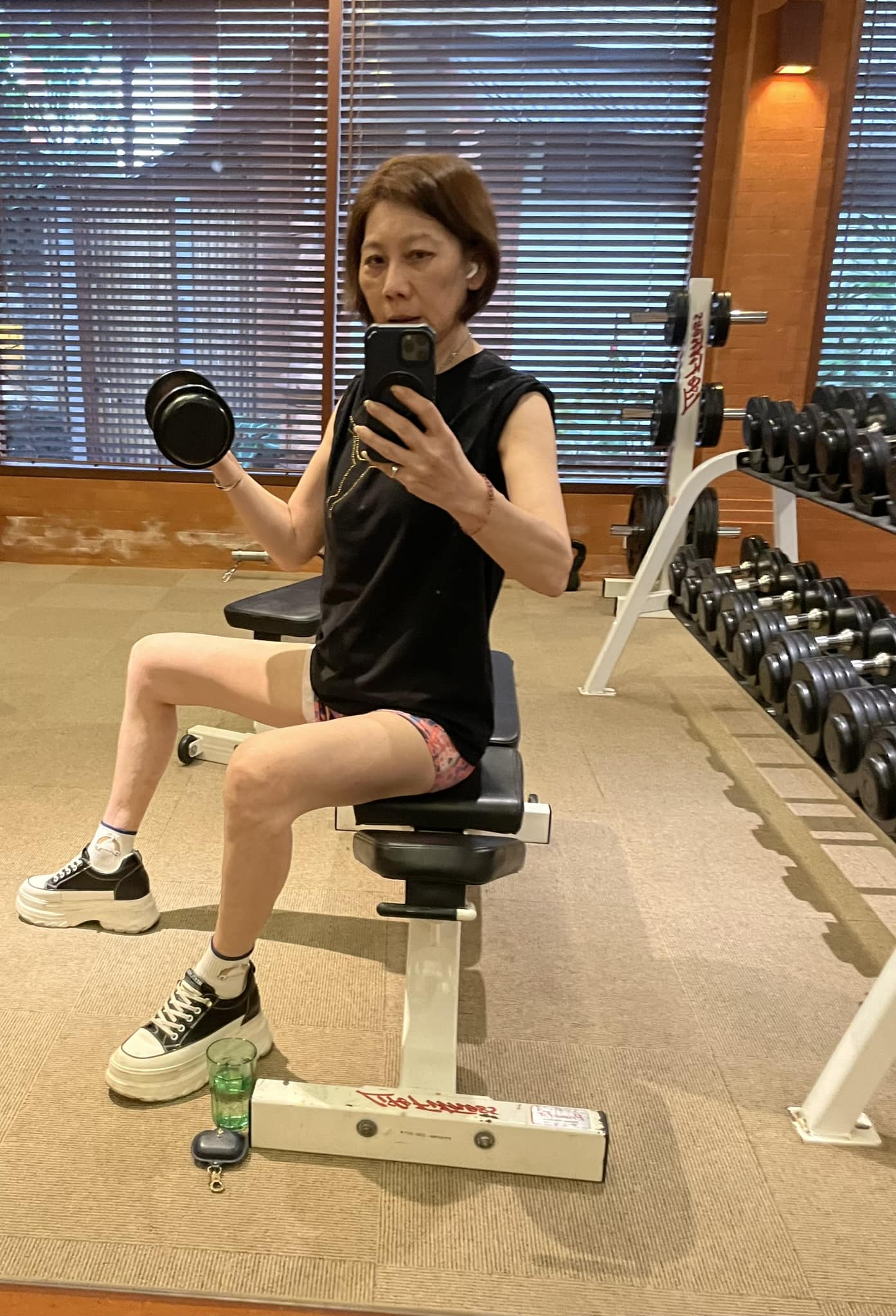 60歲劇場天后出事！驚傳「下樓踩空」傷勢曝光　崩潰「真的忍不了」：痛死了