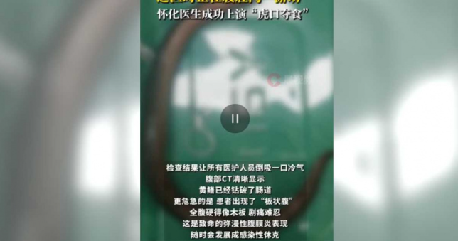 真懂玩？30歲男「一臉慘白掛急診」 醫生一照「驚見30公分的牠」當場無言　  