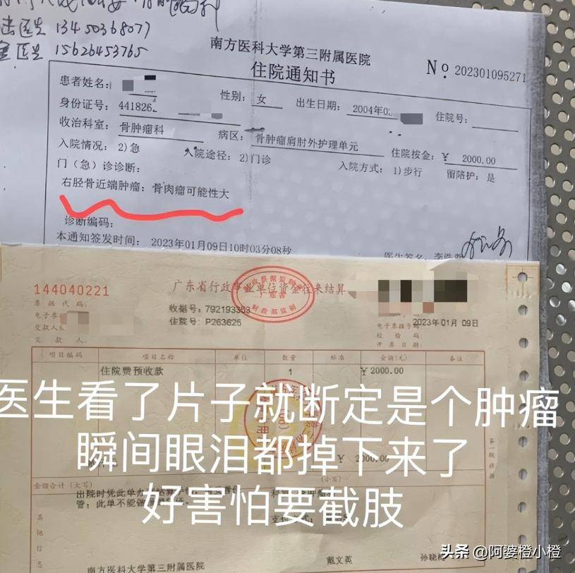 21歲大學生抗癌兩年「才被告知誤診」！瘦到剩32kg「想活只能截肢」