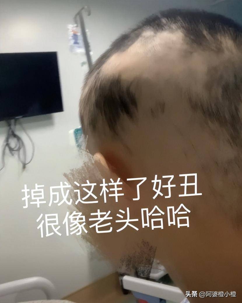 21歲大學生抗癌兩年「才被告知誤診」！瘦到剩32kg「想活只能截肢」