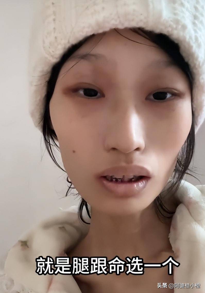 21歲大學生抗癌兩年「才被告知誤診」！瘦到剩32kg「想活只能截肢」