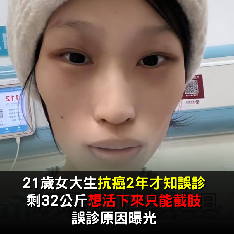 21歲大學生抗癌兩年「才被告知誤診」！瘦到剩32kg「想活只能截肢」