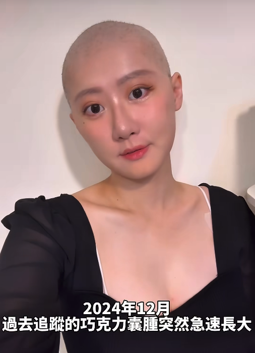 罹惡性癌症！國光女神痛哭「我還想活著」：好多心願未實現　揭現況「沒辦法再手術化療」