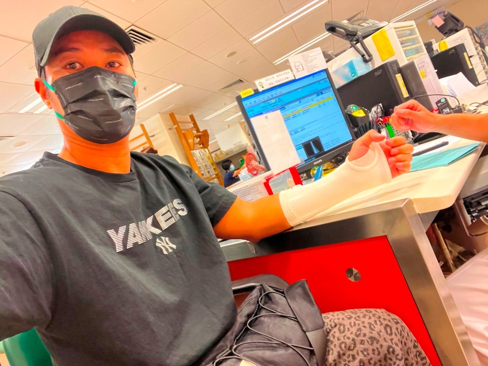 1刀砍在臉上！46歲男星「臉皮當場掉了」重傷送醫　痛苦還原過程：「縫了100針」