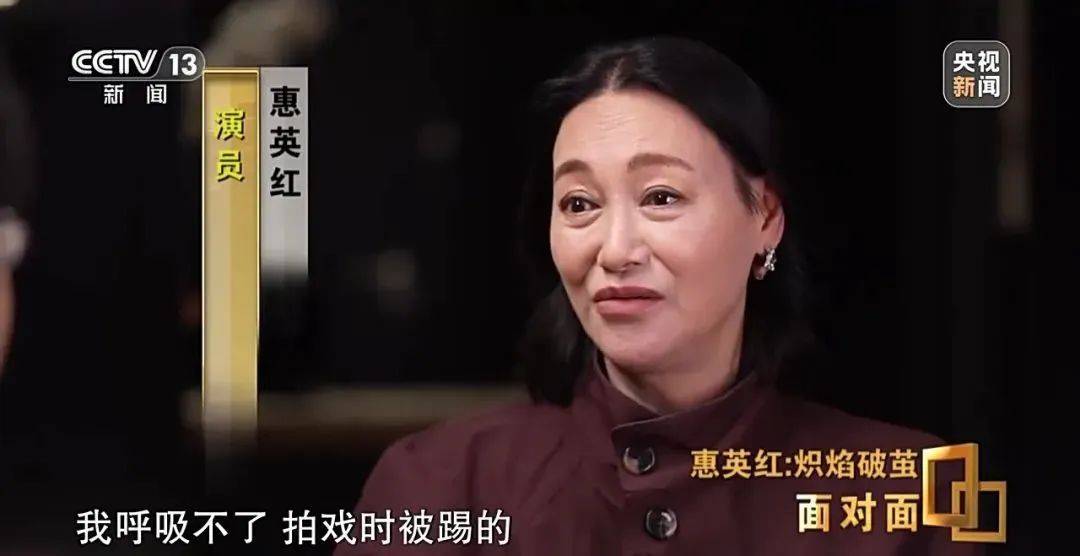 65歲影后公開認整形！曝「臉上縫89針」整個鼻子斷了　一度憂鬱「在房內口吐白沫」：靠她救回來