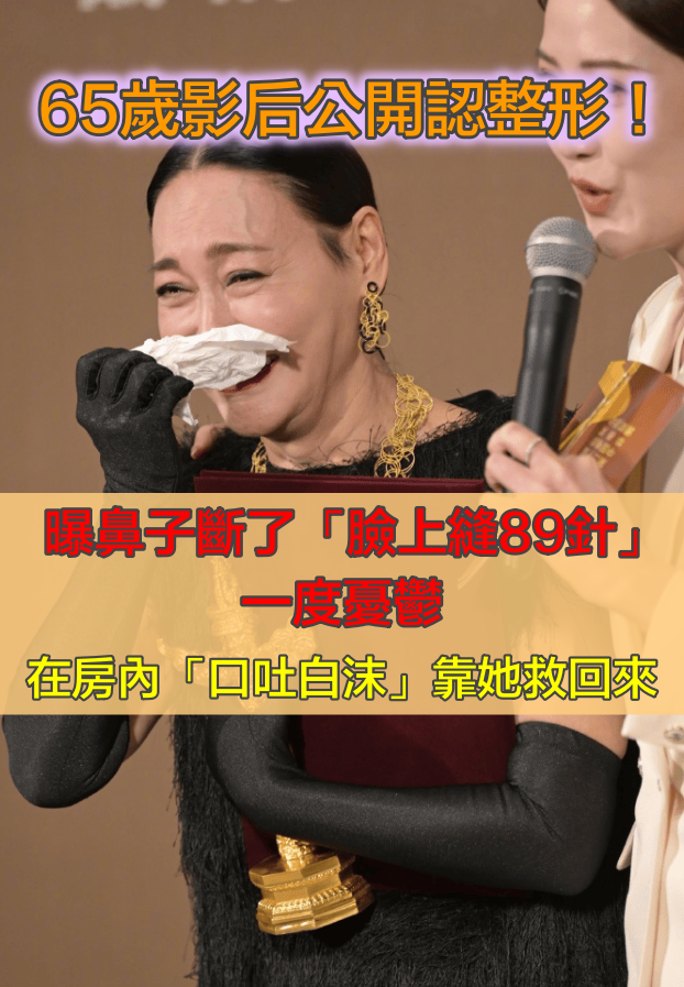 65歲影后公開認整形！曝「臉上縫89針」整個鼻子斷了　一度憂鬱「在房內口吐白沫」：靠她救回來