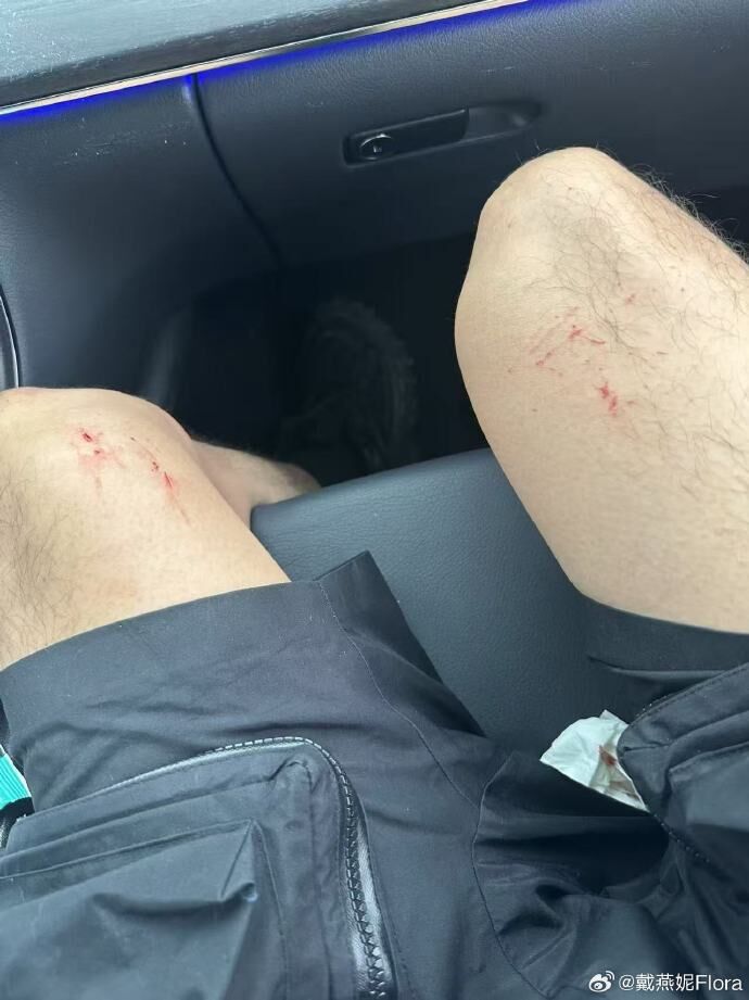 知名女星「遭遇破窗搶劫」！黑衣人猛砸副駕「玻璃全被打碎」傷勢曝光