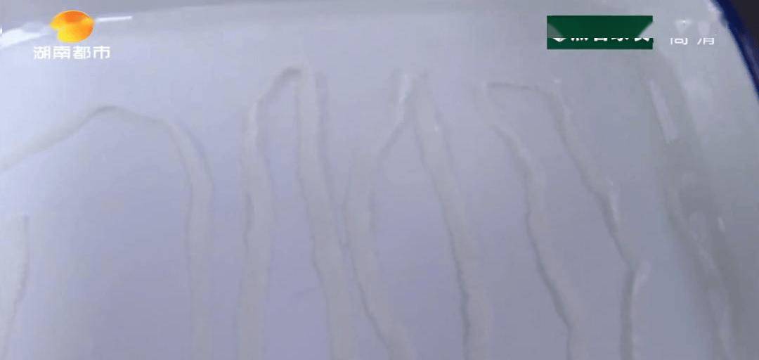 女子肚裡竟拉出「5公尺長繩」！細看竟還在動：以後不敢吃這食物了...