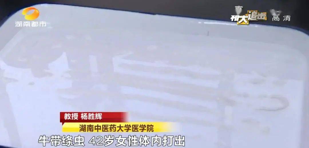 女子肚裡竟拉出「5公尺長繩」！細看竟還在動：以後不敢吃這食物了...