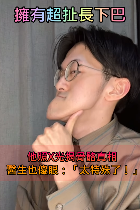 他擁有「世界最長下巴」爆紅全網！一照X光「揭開骨骼真相」醫生也傻眼：太特殊了...