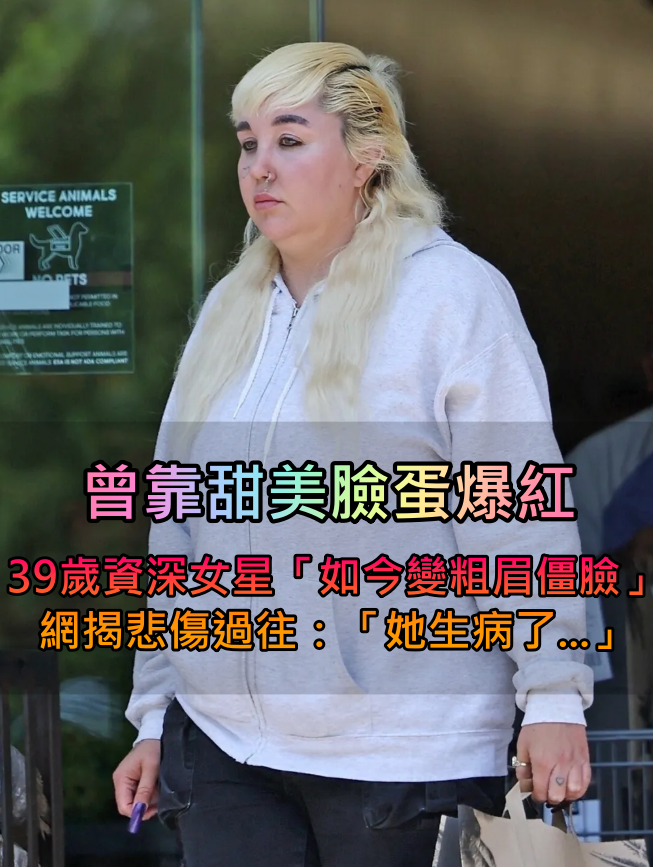 昔日是漂亮甜心！人氣女星「被拍到面容僵硬」厚唇粗眉照瘋傳　網翻出過往經歷「她生病了」