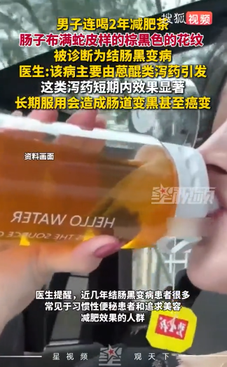 很多人中招！66歲男子「喝這種茶」2年後出事　一照腸子「全是棕黑色花紋」：像蛇皮一樣