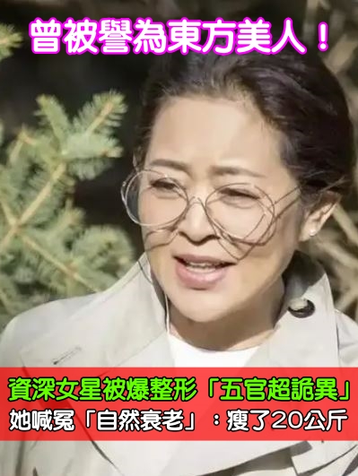 曾被譽為東方美人！資深女星被爆整形「五官超詭異」　她喊冤「自然衰老」：瘦了20公斤